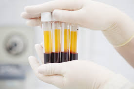 If you have at least two centers in your city, take the time to call and find out how much they pay for your first visits and. Is Selling Plasma As Easy As It Sounds Here S What To Expect