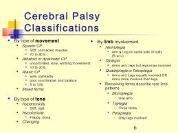 Cerebral Palsy Causes Symptoms Diagnosis Treatment Rx