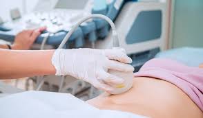 Is Pregnancy Possible A After Tubal Ligation Ivi Fertility