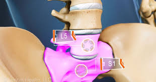 Pin On Health And Diet