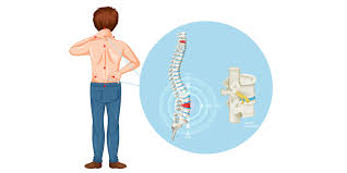 Image result for Hernia Reduction