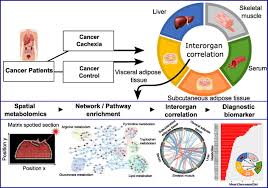 Image result for Cachexia in Cancer