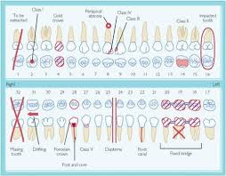 dental charting caries classification occlusion tongue