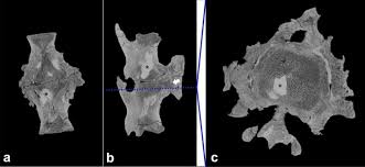 Select from premium thomas bruder of the highest quality. A Comprehensive Diagnostic Approach Combining Phylogenetic Disease Bracketing And Ct Imaging Reveals Osteomyelitis In A Tyrannosaurus Rex Scientific Reports