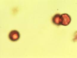 Image result for Rogiera amoena