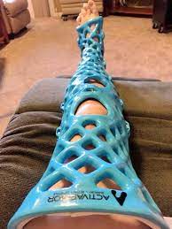 14 Genius Ideas That Should Be Everywhere By Now It Cast Prints 3d Printing