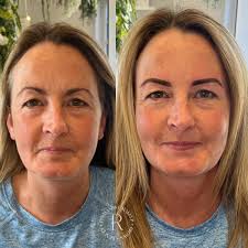 Rebekah Young Beauty