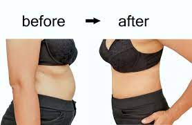 We did not find results for: How To Get Rid Of Fupa Naturally Without Surgery
