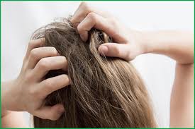 ما الذي يسبب حكة الشعر وما علاجها Shampoo For Dry Scalp Itchy Scalp Dry Itchy Scalp