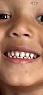 Prayers for a 5-year-old with a knocked-out tooth