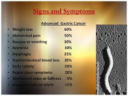 The first major statistical analysis of cancer incidence and mortality (using data gathered in verona, italy from 1760 to 1839) showed that gastric cancer was the most. Cancer Stomach