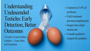 Image result for Undescended Testicle