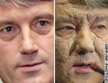 On 17 december the dutch laboratory where mr yushchenko's blood samples had been sent for analysis announced that the dioxin level was found to be 6000 … Yushchenko Poisoned Boing Boing