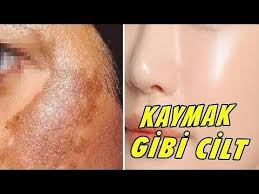 Yalniz 2 Malzeme Kusursuz Cilt Icin Porselen Etkisinde Botoks Kremsi Maske Ile Kirisiklari Soydu Youtube 2020 Cil Guzellik Maskeler