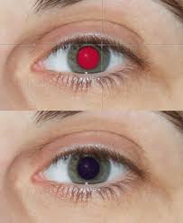 Red Eye Removal Tool Online Photo Editor Photo Retouching Online Photo