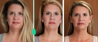 Apparently I had good self-esteem 60 days ago because I didn't realize I  looked like this. 😆 What a difference being