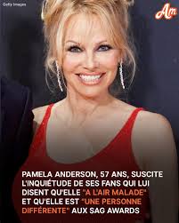 Les photos du look de Pamela Anderson aux SAG Awards 2025 qui ont suscité  l'inquiétude sont dans les commentaires. 👇😰