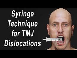 Image result for Jaw Dislocation
