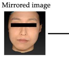 Abbreviation and denition of hard-and soft-tissue landmarks