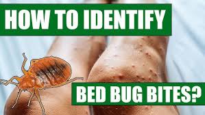 Image result for Cimex lectularius bites