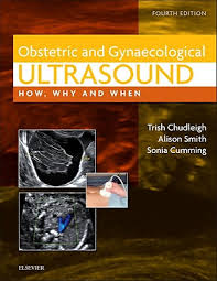 Vascular Ultrasound: 4th edition