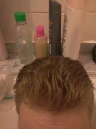 An expert guide to thick, wavy and unruly hair, including the products, cuts & styles you should go for in order to make the most of your hair texture men's fashion tips & style guide 2021 men's. Growing Out Thick And Coarse Hair Will It Get Poofier As In Bigger Or Fall Down Malehairadvice