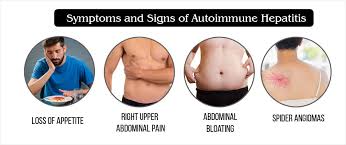 This leads to liver inflammation which eventually leads to liver scarring /cirrhosis, and eventually to liver failure. Autoimmune Hepatitis Causes Types Symptoms Complications Diagnosis Treatment