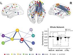 intrinsic connectomes are a predictive biomarker of