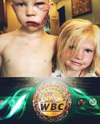 Boxeo Edwin Palacios