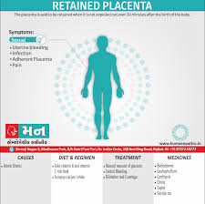 Image result for Retained Placenta