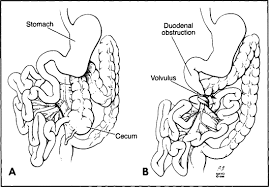 Check spelling or type a new query. Abdominal Pain In Infants And Children Mayo Clinic Proceedings