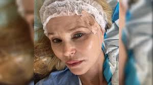 Christie Brinkley Shares Photos Of Skin Cancer Procedure, Touts "Sun  Protection'