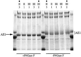 Autosomal Dominant Distal Renal Tubular Acidosis Is Associated in Three  Families with Heterozygosity for the R589H Mutation in the AE1 (Band 3)  Cl−/HCO3−Exchanger
