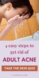 Pin On Skin Care For Acne