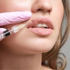 Botox Lip Flip in Islamabad-Rawalpindi ...