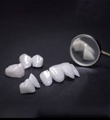 What is a Non-Prep Porcelain Crown?