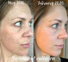 🚨TODAY I ADDED MY COLLAGEN TO THE TEA OF DAY... SO GOOD... 🛑🛑BENEFITS OF  COLLAGEN 🛑🛑 *Improves health of the skin & hair. *Reduces joint pain &  degeneration. *Helps heal leaky gut. *