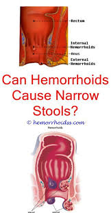 Can Hemorrhoids Go Away On Its Own Does Wasabi Trigger Hemorrhoids Can Hemorrhoids Cause Cure For Hemorrhoids Bleeding Hemorrhoids Getting Rid Of Hemorrhoids