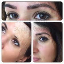 Bartus Márta Esztétikai sminktetoválás és orvosi mikropigmentáció