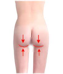 Cosmetic surgery of the buttocks in Cannes, Antibes, Monaco | Dr Laveaux