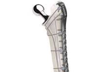 Cable Hook Locking Plate - Braun Medisys Surgicals