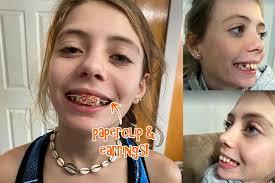 Fundraiser for Meaghan Bonina by Erika Stokes : Orthodontic Braces for Avery