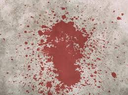 Follow these steps when cleaning up a blood spill: Blood Cleanup Services Pureone Services Call Us 24 7