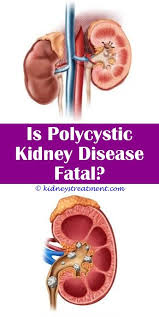 Kidney Function Labs Chronic Kidney Disease Kidney Disease Symptoms Kidney Failure Symptoms