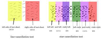 The line bisection test is commonly used to detect and evaluate the performance of patients with unilateral or hemispatial spatial neglect. Analysis Method For Line And Star Cancellation Test Download Scientific Diagram