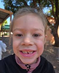 Jou eerste tand in n geel koevertjie reg vir die tande muis 🐭 Ons het nou  n haasbekkie 🥲🥲🥲 So onverwags! Niks soos mylpale wat klem plaas op die  hoeveelheid tyd wat