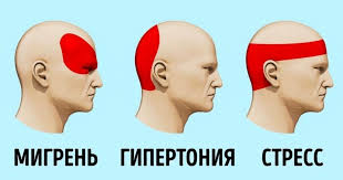 Golovnye Boli Pri Gipertonii Blog Doktora Shishonina Yandeks Dzen