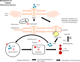 Image result for Copper Poisoning