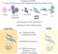 Tidak perlu saling meremehkan, karena pada dasarnya tuhan memberikan kecerdasan pada otak manusia itu sama, tinggal bagaimana cara kita mengasahnya. Cells Free Full Text Ips Derived Early Oligodendrocyte Progenitor Cells From Spms Patients Reveal Deficient In Vitro Cell Migration Stimulation Html
