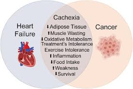 Image result for Cachexia in Cancer